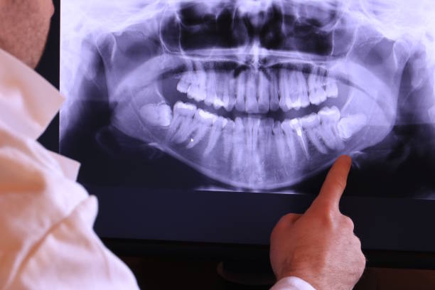 Best Broken or Cracked Tooth Emergency Dentist in Fruitport, MI